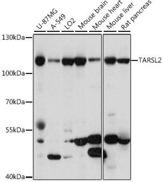 Metabolism Antibodies 3 Anti-TARSL2 Antibody CAB15945