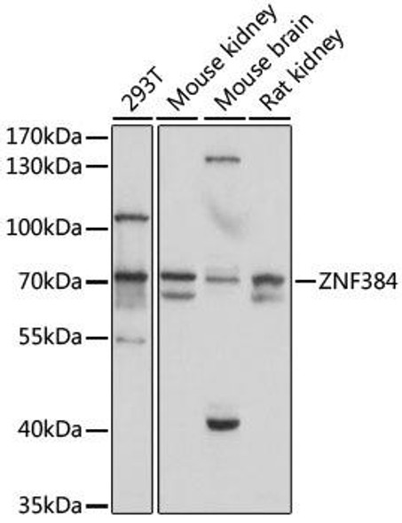 Epigenetics and Nuclear Signaling Antibodies 2 Anti-ZNF384 Antibody CAB15964