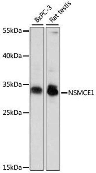 Epigenetics and Nuclear Signaling Antibodies 2 Anti-NSMCE1 Antibody CAB15966