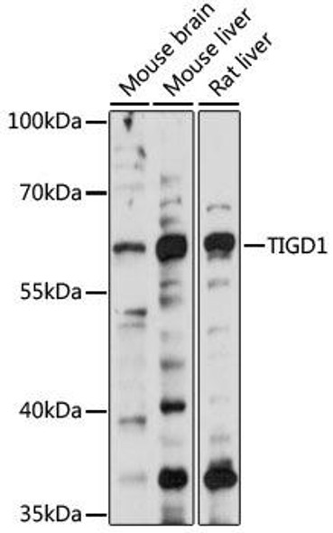 Cell Biology Antibodies 6 Anti-TIGD1 Antibody CAB15967