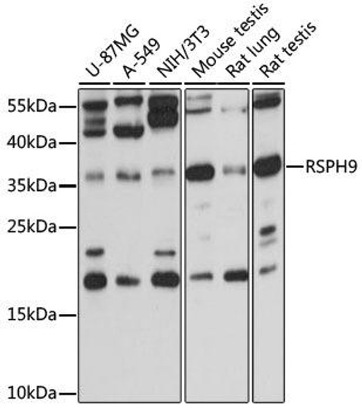 Cell Biology Antibodies 6 Anti-RSPH9 Antibody CAB15972