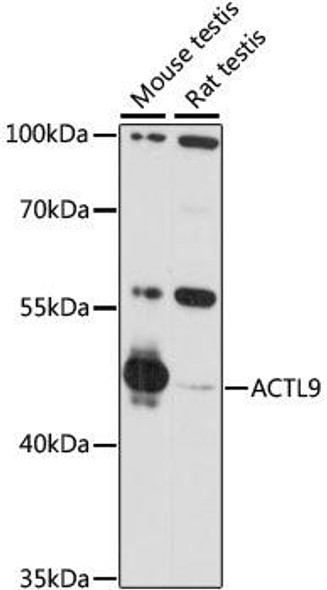 Cell Biology Antibodies 6 Anti-ACTL9 Antibody CAB15974