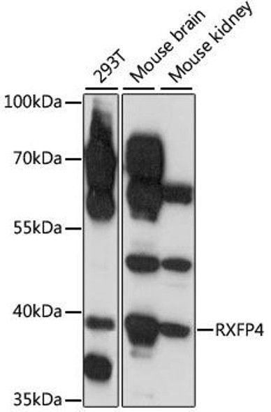 Cell Biology Antibodies 6 Anti-RXFP4 Antibody CAB15978