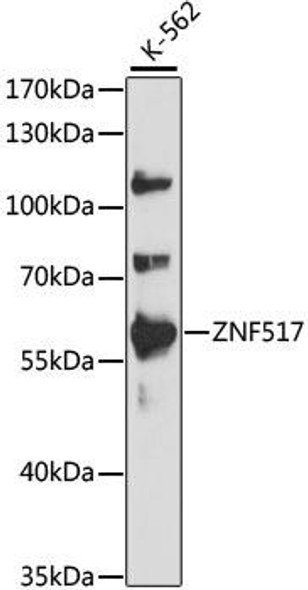 Epigenetics and Nuclear Signaling Antibodies 2 Anti-ZNF517 Antibody CAB15979