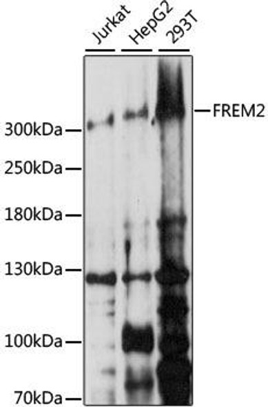 Cell Biology Antibodies 6 Anti-FREM2 Antibody CAB15980