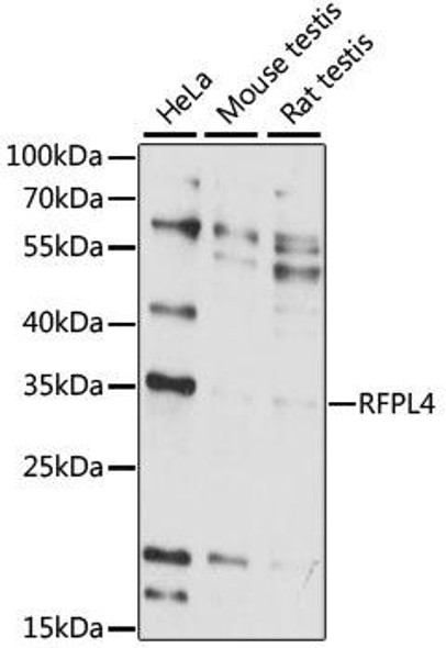 Cell Biology Antibodies 6 Anti-RFPL4 Antibody CAB15981