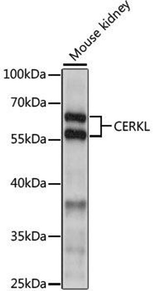 Cell Biology Antibodies 6 Anti-CERKL Antibody CAB15984