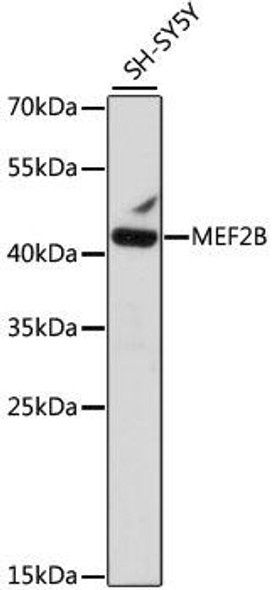 Epigenetics and Nuclear Signaling Antibodies 2 Anti-MEF2B Antibody CAB15987