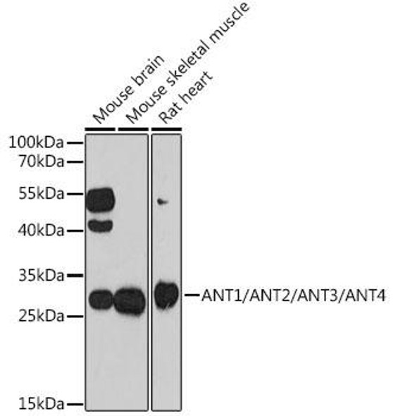 Cell Biology Antibodies 6 Anti-ANT1/ANT2/ANT3/ANT4 Antibody CAB15988