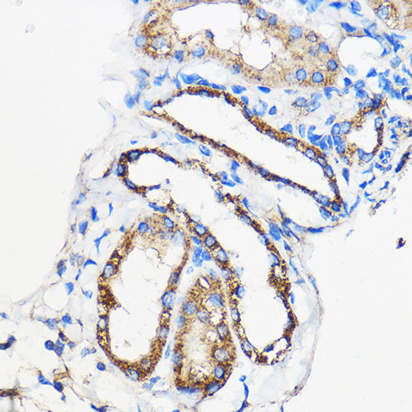 Cell Biology Antibodies 6 Anti-ANT1/ANT2/ANT3/ANT4 Antibody CAB15988