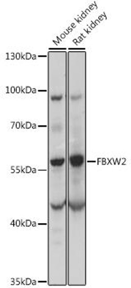 Signal Transduction Antibodies 2 Anti-FBXW2 Antibody CAB15996