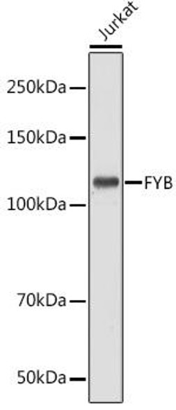 Cell Biology Antibodies 6 Anti-FYB Antibody CAB15997