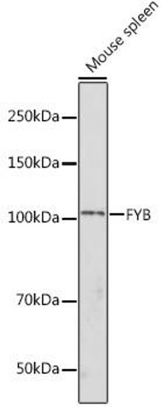 Cell Biology Antibodies 6 Anti-FYB Antibody CAB15997