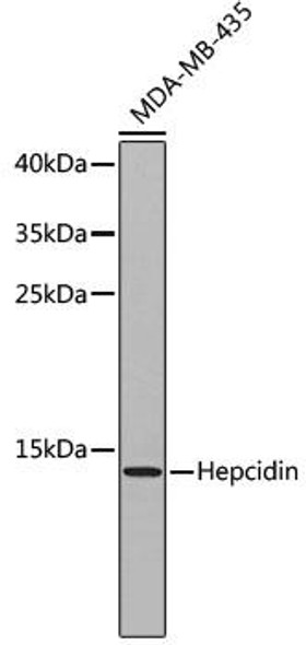 Cell Biology Antibodies 6 Anti-Hepcidin Antibody CAB1601