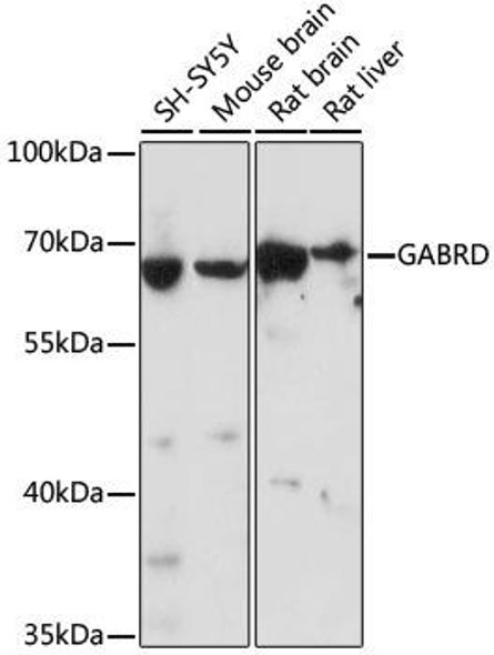 Signal Transduction Antibodies 2 Anti-GABRD Antibody CAB16016