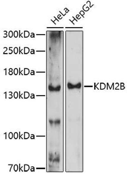 Epigenetics and Nuclear Signaling Antibodies 2 Anti-KDM2B Antibody CAB16017