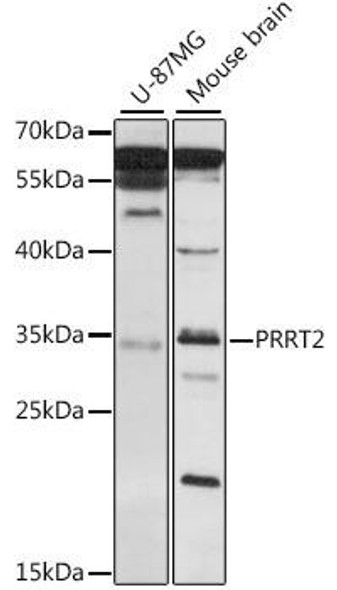 Cell Biology Antibodies 6 Anti-PRRT2 Antibody CAB16027