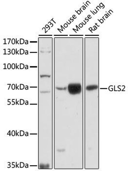 Cell Biology Antibodies 6 Anti-GLS2 Antibody CAB16029