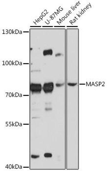 Immunology Antibodies 2 Anti-MASP2 Antibody CAB16030