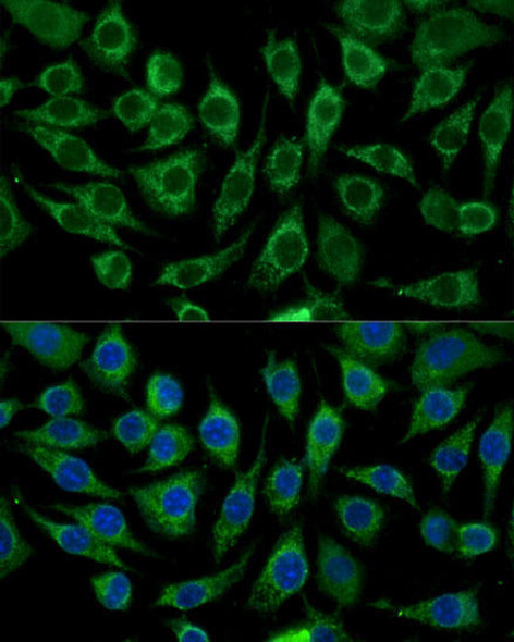 Signal Transduction Antibodies 2 Anti-ABCD2 Antibody CAB16033