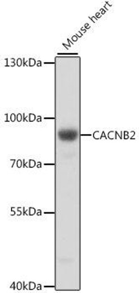 Cell Biology Antibodies 6 Anti-CACNB2 Antibody CAB16037