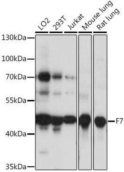 Cardiovascular Antibodies Anti-F7 Antibody CAB16044