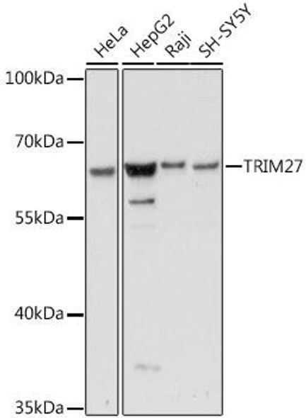 Epigenetics and Nuclear Signaling Antibodies 2 Anti-TRIM27 Antibody CAB16065