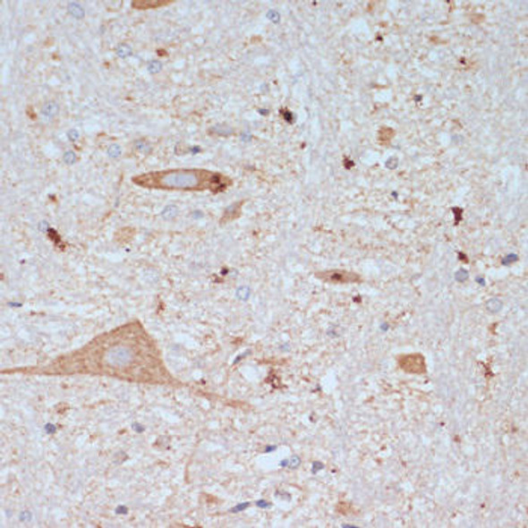 Neuroscience Anti-SLC18A3 Antibody CAB16068