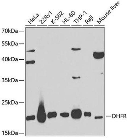 Immunology Antibodies 2 Anti-DHFR Antibody CAB1607