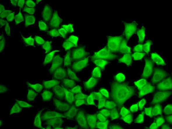 Immunology Antibodies 2 Anti-DHFR Antibody CAB1607