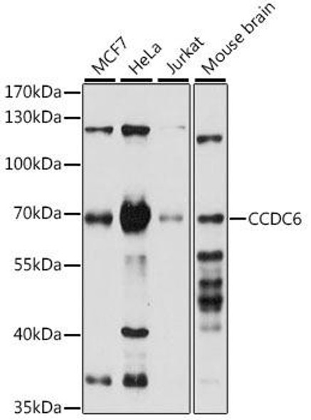 Cell Biology Antibodies 6 Anti-CCDC6 Antibody CAB16075