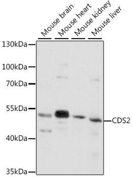 Metabolism Antibodies 3 Anti-CDS2 Antibody CAB16080