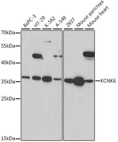 Signal Transduction Antibodies 2 Anti-KCNK6 Antibody CAB16087
