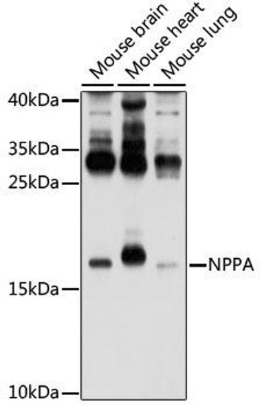 Cell Biology Antibodies 6 Anti-NPPA Antibody CAB1609