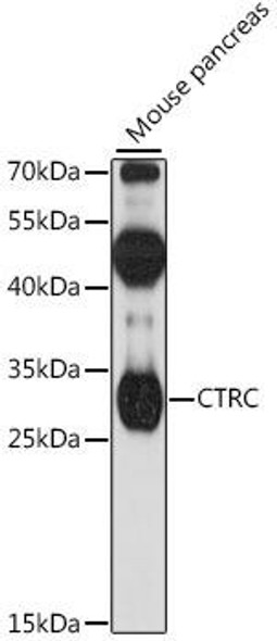 Cell Biology Antibodies 6 Anti-CTRC Antibody CAB16104