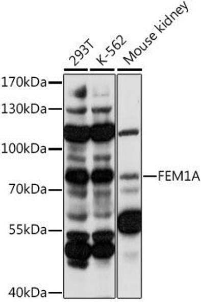 Signal Transduction Antibodies 2 Anti-FEM1A Antibody CAB16129