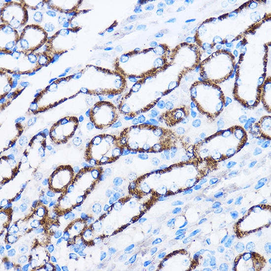 Immunology Antibodies 2 Anti-IL-23R Antibody CAB1613
