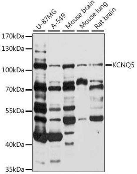 Signal Transduction Antibodies 2 Anti-KCNQ5 Antibody CAB16134