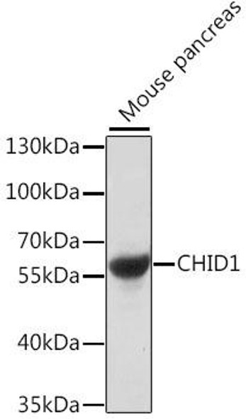 Immunology Antibodies 2 Anti-CHID1 Antibody CAB16142