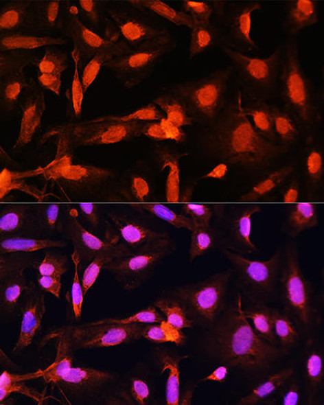 Cell Cycle Antibodies 1 Anti-SGOL1 Antibody CAB16174