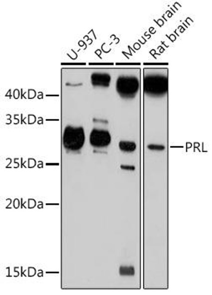 Cell Biology Antibodies 6 Anti-PRL Antibody CAB1618