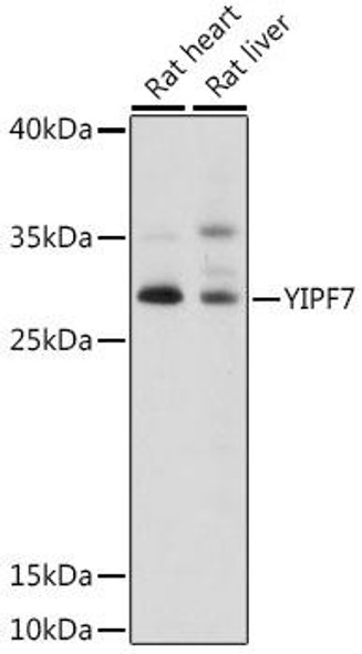 Cell Biology Antibodies 6 Anti-YIPF7 Antibody CAB16180