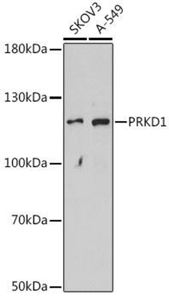 Cardiovascular Antibodies Anti-PRKD1 Antibody CAB16185