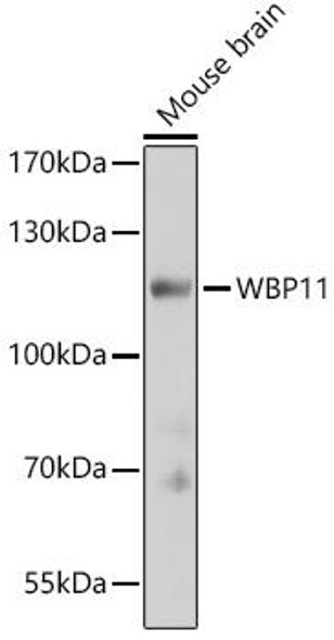 Epigenetics and Nuclear Signaling Antibodies 2 Anti-WBP11 Antibody CAB16191