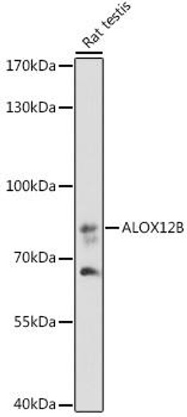 Metabolism Antibodies 3 Anti-ALOX12B Antibody CAB16210