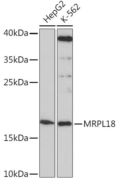 Signal Transduction Antibodies 2 Anti-MRPL18 Antibody CAB16231