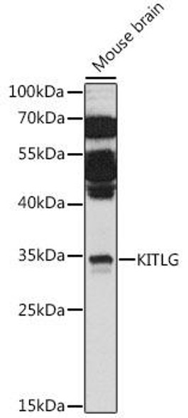 Cell Biology Antibodies 6 Anti-KITLG Antibody CAB16245