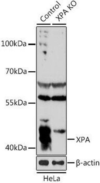 KO Validated Antibodies 1 Anti-XPA Antibody CAB1626KO Validated
