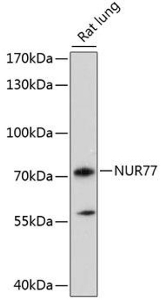 Epigenetics and Nuclear Signaling Antibodies 2 Anti-NUR77 Antibody CAB16264