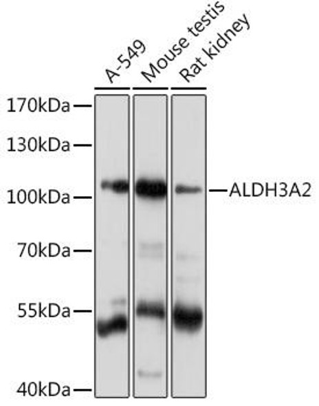 Metabolism Antibodies 2 Anti-ALDH3A2 Antibody CAB16267